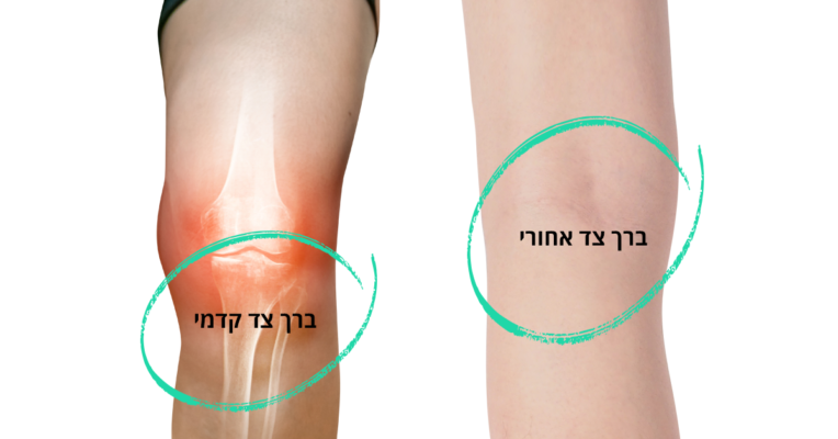 סוליו - טיפול בכאבי ברכיים